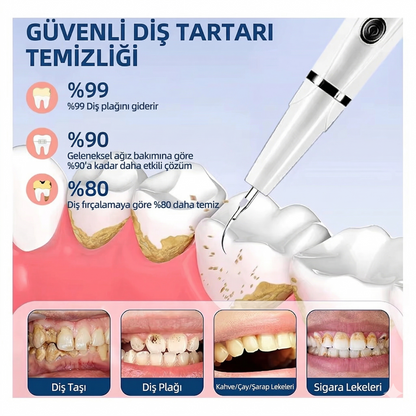 OraluxPro Ultrasonik Diş Taşı Temizleme Cihazı – LED Işıklı, 5 Mod, 3 Yedek Başlık